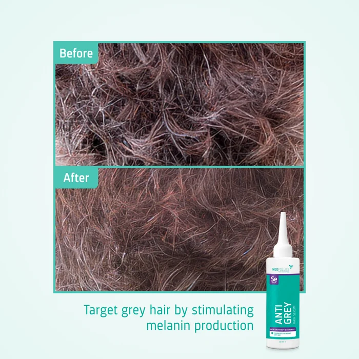 Anti Grey Hair Serum before after