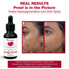 Anti - Pigmentation Serum & Sunscreen - The Skin Story - Face Care