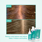 Scalp Therapy Healthy scalp routine before after