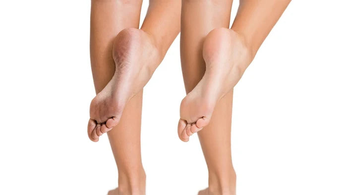 i-Spa Heel Peel Online Course