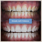 Non-Slip Teeth Whitening Strips - Iconic White