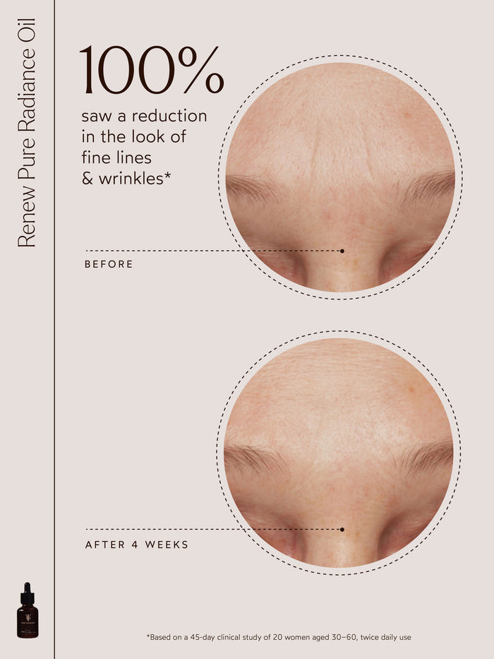 Comparison of forehead skin showing visible reduction in fine lines and wrinkles after 4 weeks of using Renew Pure Radiance Oil | True Botanicals in skincare routine.