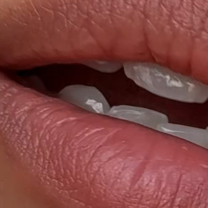 Teeth Whitening Kit